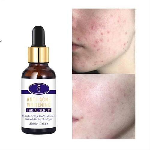 Serum anti-acne aclarante de manchas - Imagen 2