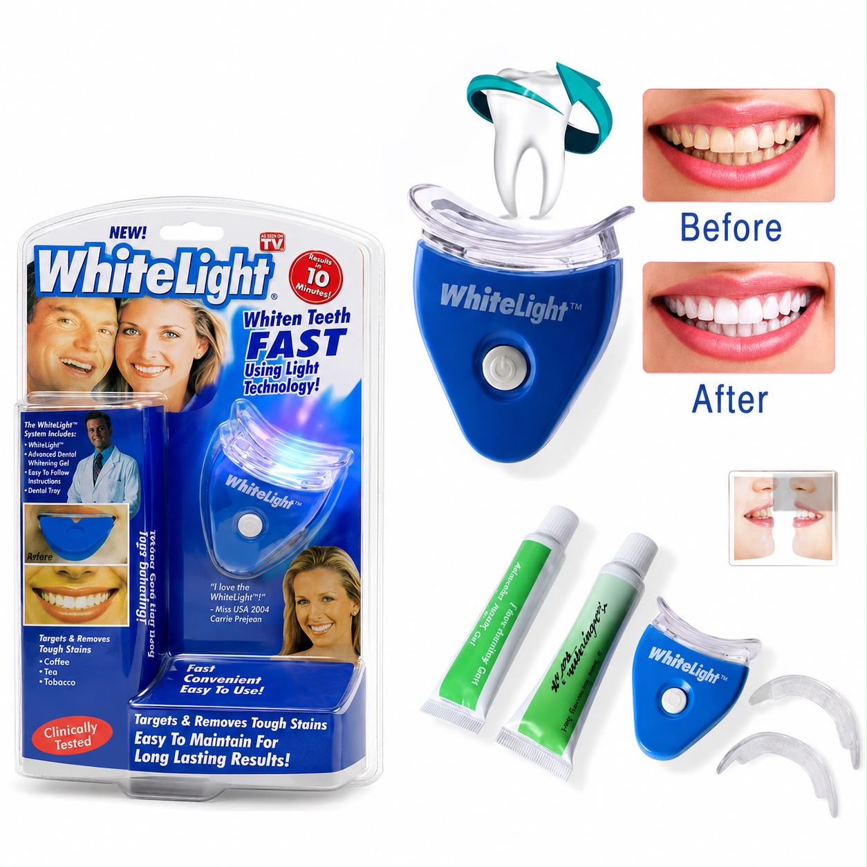 Kit blanqueamiento dental